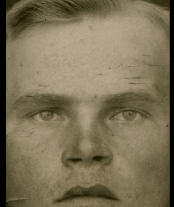 Example of a positive match in which the arcus supraciliaris is evaluated with Skeleton·ID by means of the transparency and wipe tools, showing that the arcus supraciliaris of the face follows the supraorbital margin of the skull in a consistent way. The wipe tool has been used to show a gradient from right to left (anatomical) of the supraorbital margin over the arcus supraciliaris