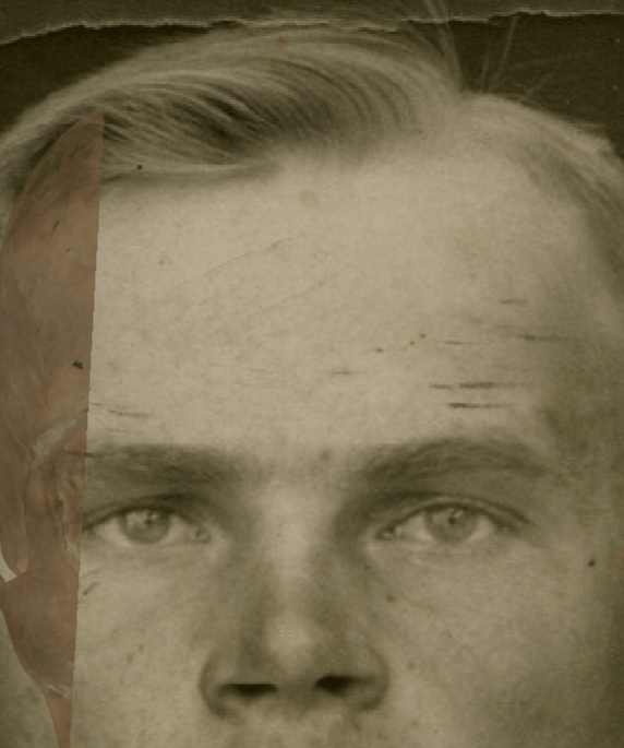 Example of a negative match in which the arcus supraciliaris is evaluated with Skeleton·ID by means of the transparency and wipe tools, showing that the arcus supraciliaris of the face does not follow the supraorbital margin of the skull in a consistent way. The wipe tool has been used to show a gradient from right to left (anatomical) of the supraorbital margin over the arcus supraciliaris. In this case the supraorbital margin on the skull is located above the superciliary arch on the face, showing inconsistency between both anatomical structures