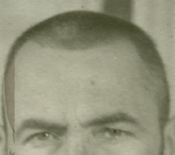 Example of a negative match in which the cranial width is evaluated with Skeleton·ID by means of the transparency and wipe tools showing inconsistency with the facial width. The width of the skull is greater than the width of the face, protruding from the facial contour