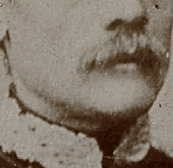 Example of a positive match in which the chin outline is evaluated with the transparency and wipe tools, showing that the chin outline is consistent with the mental outline. The wipe tool has been used to show a gradient from right to left (anatomical) of the mental outline (skull) over the chin outline