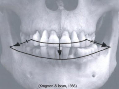Corners on radiating lines from first premolar-canine junction (Krogman e Iscan, 1986)