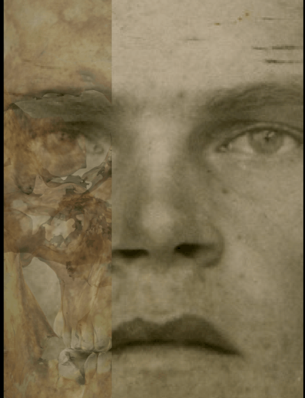 Example of a positive match in which the piriform aperture width and height is visually evaluated with Skeleton·ID by means of the transparency and wipe tools, showing that the piriform aperture width and height lies within the borders of the nose in a consistent way. The transparency tool has been used in combination with the wipe tool to show a gradient from the right to the left (anatomical) alare showing the position of the piriform aperture in relation to the nose in the face